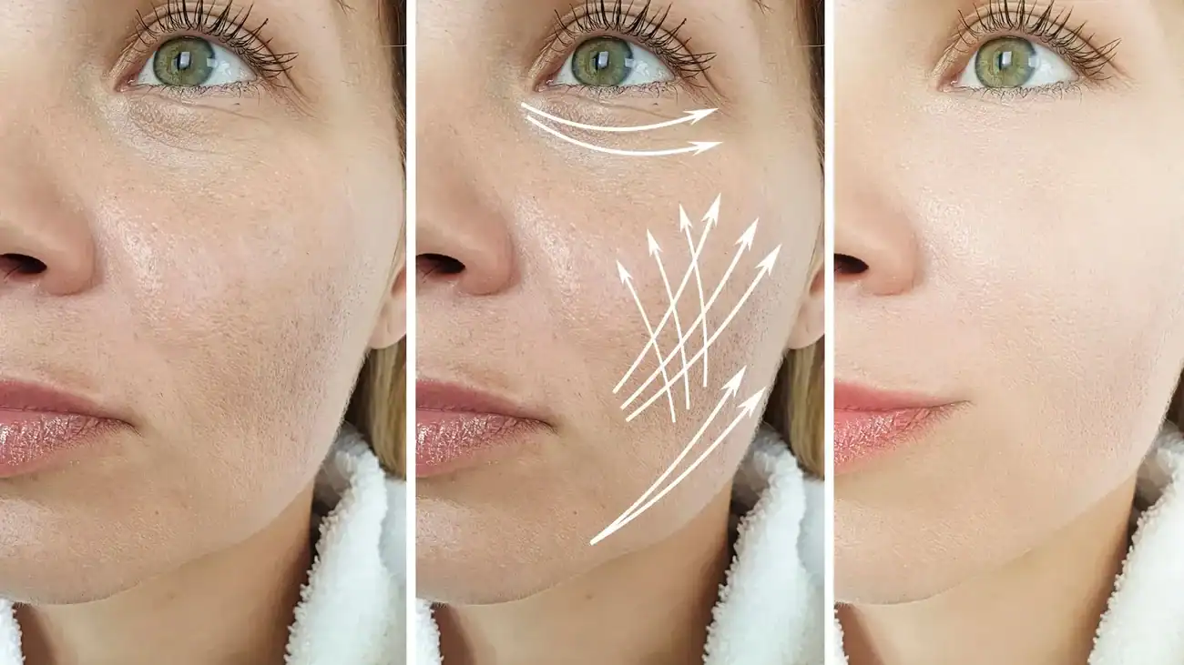 Can One Treatment Really Tackle More Than One Skin Concern Chester?