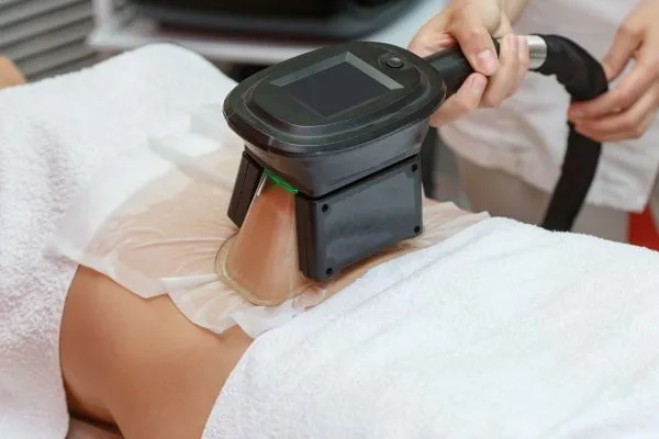 Image of person having fat freezing treatment to help weight gain Chester