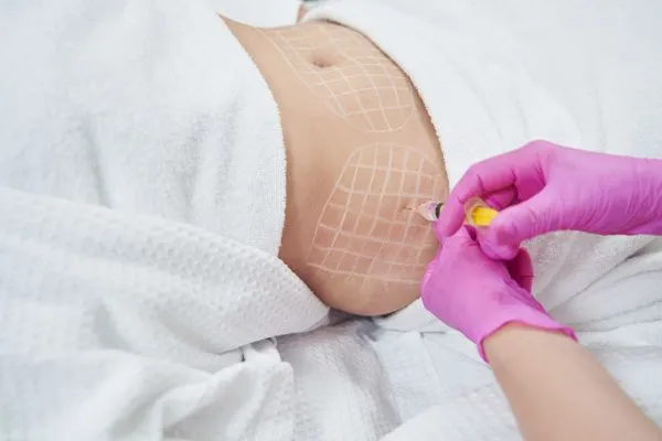 image of fat dissolving injections on love handles to help combat weight gain Chester