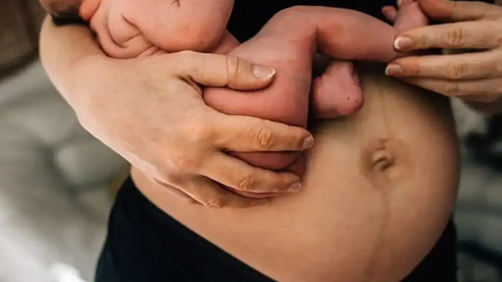 Why Is My Stomach Still Big After Pregnancy Chester?